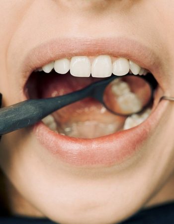 Open mouth during dental exam with mouth mirror